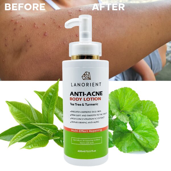 Body Lotion Factory - OEM Custom Private Label