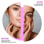 Soap Bar Manufacturer - Private Label Organic Collagen