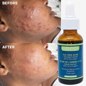 Skin Brightening Serum Manufacturer - Private Label Korean