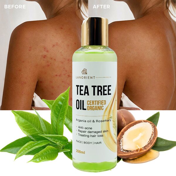 Body Massage Oil Factory - Low Moq Customized LANORIENT