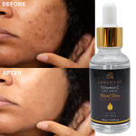 Skin Care Serum Manufacturer - Private Label Organic Vitamin