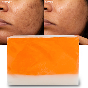 Papaya Honey Soap Manufacturer - Private Label Skin