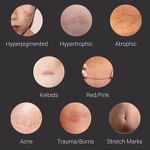 Scar Erase Tape Manufacturer - Skin Repairing Silicone Gel