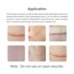 Silicone Gel Tape Factory - Skin Smooth Elastic Non-Irritating