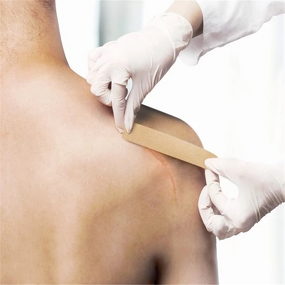 Keloid Sheet Manufacturer - Transparent Silicone Removal