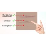Scar Erase Tape Manufacturer - Skin Repairing Silicone Gel