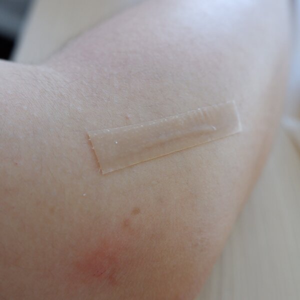 Waterproof Scar Roll Factory - Skin Smooth Keloid Patch