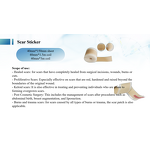 Silicone Gel Tape Factory - Skin Smooth Elastic Non-Irritating