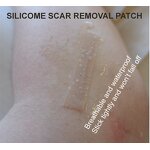 Waterproof Gel Pads Manufacturer - Medical Skin Smooth Scar