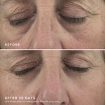 Hydrogel Eye Patch Factory - Factory Wholesale OEM/ODM