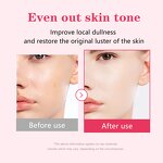 Niacinamide Serum Manufacturer - Customizable Hyaluronic Acid