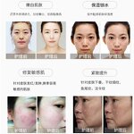 Skin Rejuvenation Machine Manufacturer - Jet Water Light OEM