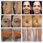 Body Slimming Machine Supplier - Inbody Face Lift Device