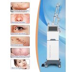 Diode Laser Machine Supplier - 1064nm Skin Tightening Stretch