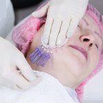 Nose Lift Thread Factory - Heremefill Beauty Products