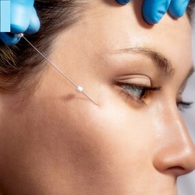 Nose Lift Thread Factory - Heremefill Beauty Products