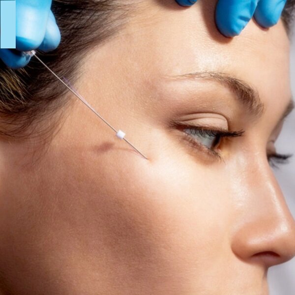 Nose Lift Thread Factory - Heremefill Beauty Products