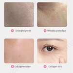 Hyaluronic Acid Serum Factory - Heremefill Skin Care