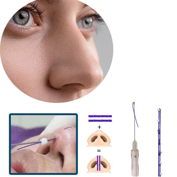 Single Pdo Thread Manufacturer - Heremefill Hot Selling