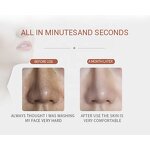 RF Facial Massager Factory - Home Use Ultrasonic EMS