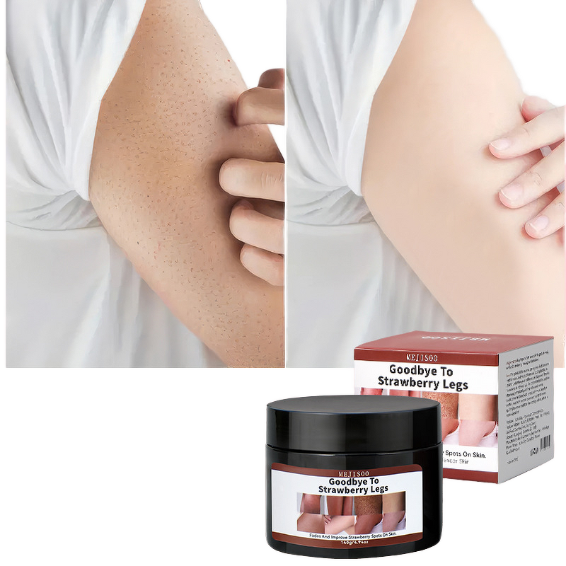 Chicken Skin Cream Factory - Long-Lasting Removes Pimples