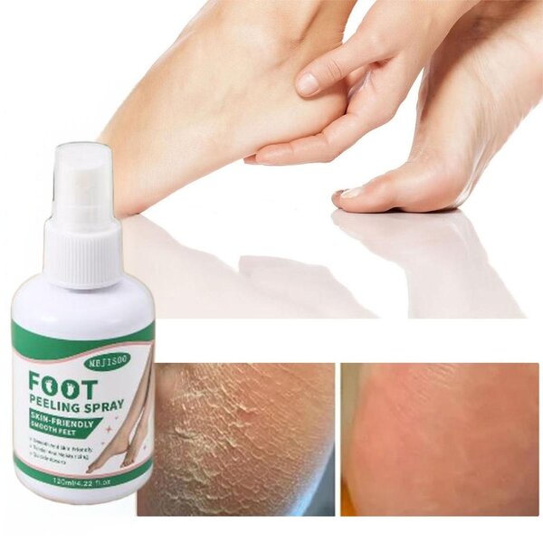 Foot Exfoliating Spray Manufacturer - MEJISOO Deep Cleaning