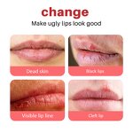 Lip Care Manufacturer - Lightens Lip Lines Brightens