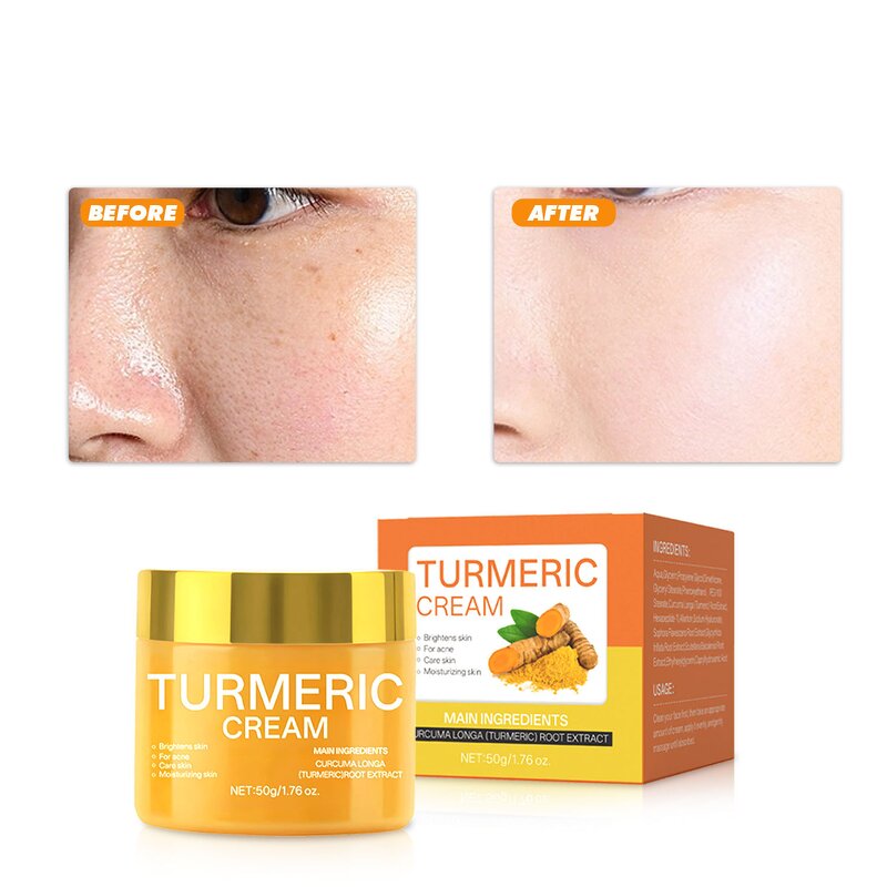 Turmeric Face Cream Manufacturer - Natural Brightens Skin
