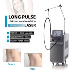 Hair Removal Machine Factory - Bulk Hot Sale Alexandrite 755nm1064nm Long Pulsed Home