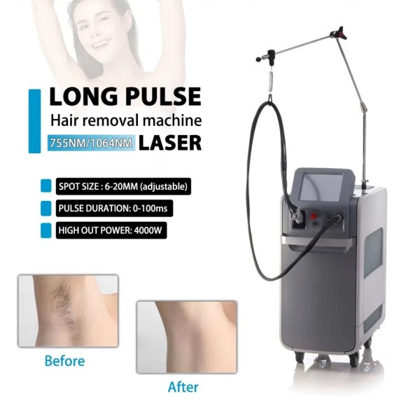 Hair Removal Machine Factory - Bulk Hot Sale Alexandrite 755nm1064nm Long Pulsed Home