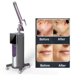 Co2 Laser Machine Manufacturer - OEM New Design Co2 Laser Face Lift Beauty Care Skin Tightening