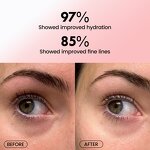 Eye Patch Factory - OEM Private Label Anti-acne Pink Moisturizing