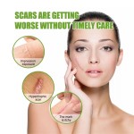 Electric Acne Patch Supplier - Bulk 2024 New Electric Acne Patch Invisible Master Hyaluronic