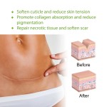 Electric Acne Patch Supplier - Bulk 2024 New Electric Acne Patch Invisible Master Hyaluronic