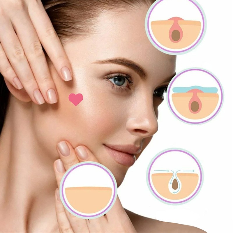 Pimple Patch Supplier - OEM Pimple Patch Hydrocolloid Spot Patch Heart Shape Acne