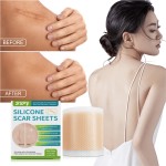 Electric Acne Patch Supplier - Bulk 2024 New Electric Acne Patch Invisible Master Hyaluronic