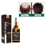 Hair Growth Oil Manufacturer - OEM Natural Moisturizing Anti Hair Loss