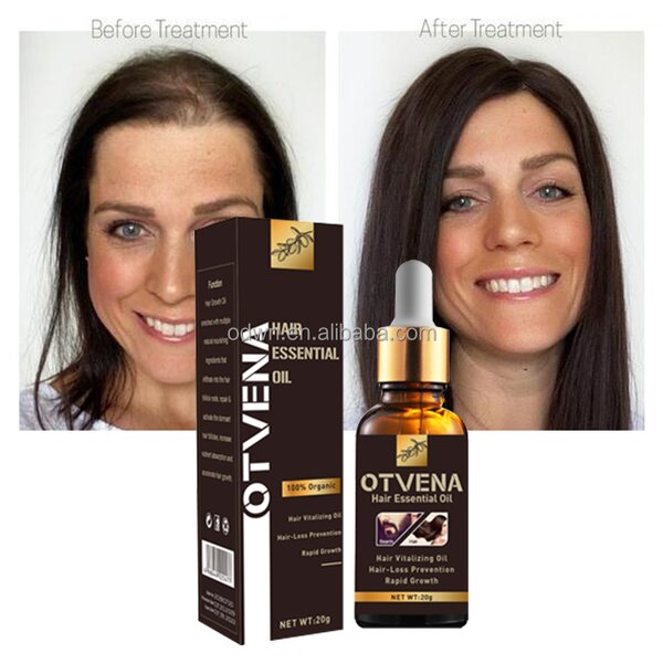 Hair Growth Oil Manufacturer - Private Label Organic Promote Growth