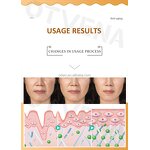 Anti Aging Cream Manufacturer - Thailand Hot Selling Collagen Moisturizer