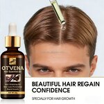 Hair Care Oil Manufacturer - Famous Fast Growth Anti Hair Loss 20ml