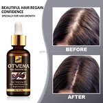 Hair Care Oil Manufacturer - Famous Fast Growth Anti Hair Loss 20ml