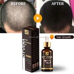 Hair Growth Oil Manufacturer - OEM Organic Fast Hair Loss Treatment
