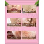 Whitening Cream Manufacturer - For All Skin Types Fades Spots Moisturizes