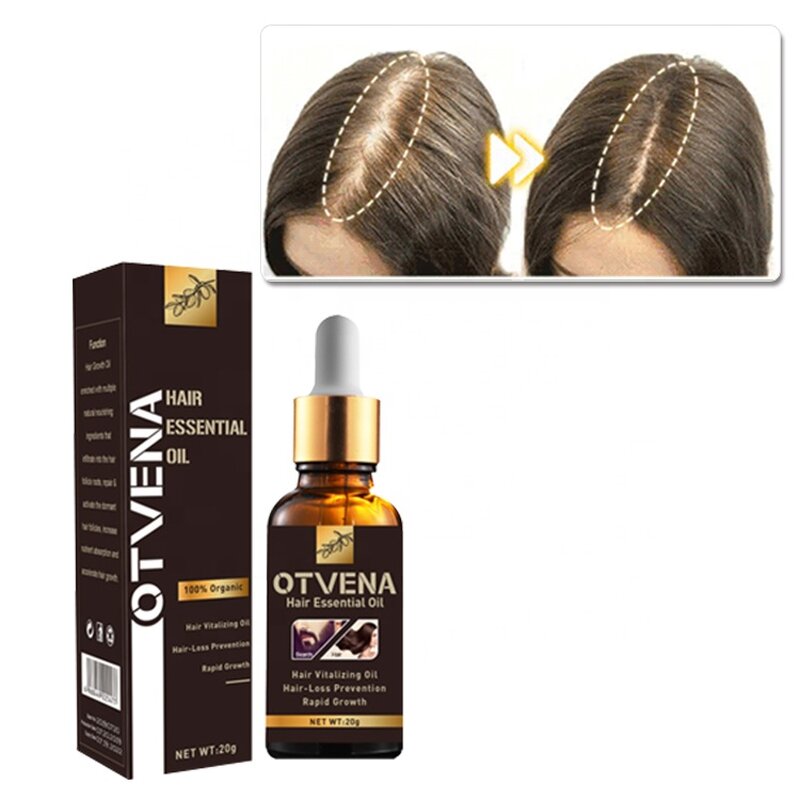 Hair Growth Oil Manufacturer - OEM Natural Moisturizing Anti Hair Loss