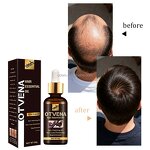 Hair Growth Oil Manufacturer - Organic Fast Hair Loss Treatment