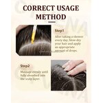 Hair Care Oil Manufacturer - Famous Fast Growth Anti Hair Loss 20ml