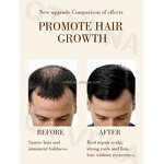 Hair Care Oil Manufacturer - OEM Famous Fast Growth Anti Hair Loss 20ml