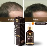 Hair Growth Oil Manufacturer - Organic Fast Hair Loss Treatment