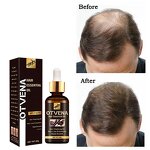 Hair Growth Oil Manufacturer - Natural for Hair & Beard See Results