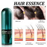 Hair Essence Manufacturer - Fast Repair & Nourish Prevents Hair Loss